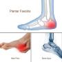 Silicone Gel Heel Cups - Shoe Inserts for Plantar Fasciitis, Sore Heel Pain, Bone Spur & Achilles Pain - Pad and Shock Absorbing Support for Women (2 Pairs/4Pcs)