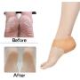Madholly 5 Pairs Gel Heel Sleeves, Breathable Silicone Heel Socks Protectors to Repair Dry Cracked Heel and Reduce Pains of Plantar Fasciitis, Achilles Tendonitis Tendon, Heel Spurs, Sore Heel