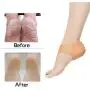Madholly 5 Pairs Gel Heel Sleeves, Breathable Silicone Heel Socks Protectors to Repair Dry Cracked Heel and Reduce Pains of Plantar Fasciitis, Achilles Tendonitis Tendon, Heel Spurs, Sore Heel