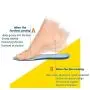 MQUPIN Plantar Fasciitis Gel Insoles for Women / Men, Arch Support & Pain Relief & Flat Feet Correction Shoe Pads for Sneakers, Heels, Work Boots, 6 - 10 Size (2 Pairs)