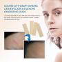 Aroamas Professional Silicone C-Section Scar Removal Sheets, Soft Adhesive Fabric Strips, Drug-Free, Relieves Itching, Remove Keloid Scars, Acne. 5.9" ? 1.6", 4 pcs (2 Month Supply), Beige