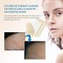 Aroamas Professional Silicone Scar Sheets, Soften and Flattens Scars Resulting from Surgery, Injury, Burns, Acne, C-section and more, Soft Silicone Scar Strips, 3&quot×1.57&quot, 8 Sheets (4 Month Supply)