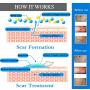 ScarOut! Silicone Scar Sheets for Scar Removal (2 Month Supply) - C Section Recovery Scar Treatment, Keloid Scar Removal and more! - 5x Silicon Sheets For Scars in two sizes - Scar Gel Silicone Tape
