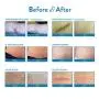 Aroamas Professional Silicone Scar Sheets, Soften and Flattens Scars Resulting from Surgery, Injury, Burns, Acne, C-section and more, Soft Silicone Scar Strips, 3"×1.57", 8 Sheets (4 Month Supply)