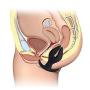 SM Penis Cock Rings - Namee Waterproof Ultra soft Silicone Penis Ring Clitoral Stimulate Prostate Anal Sex Toys for Men Women Couple