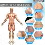 ScarOut! Silicone Scar Sheets for Scar Removal (2 Month Supply) - C Section Recovery Scar Treatment, Keloid Scar Removal and more! - 5x Silicon Sheets For Scars in two sizes - Scar Gel Silicone Tape