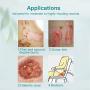 Silicone Foam Dressing with Border Adhesive Waterproof 4&quot*4&quot(10 cm*10 cm) Pack of 10 Square Dressing for Wound Care